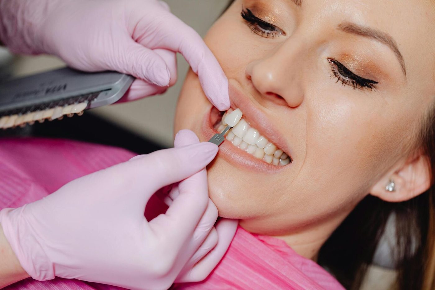 How to Find a Top Cosmetic Dentist Near You