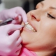 Dentist holding a porcelain veneer beside a patient's natural front tooth