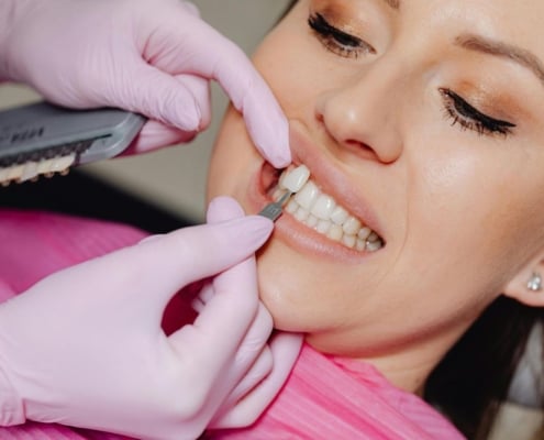Dentist comparing a porcelain veneer shade to a patient's front teeth