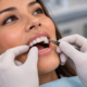 Porcelain veneer being placed on a patient's front tooth
