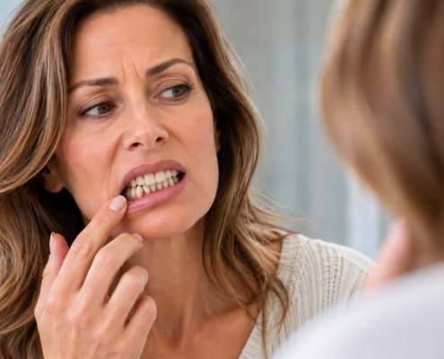 Woman examining shifting and crowded lower teeth in a mirror